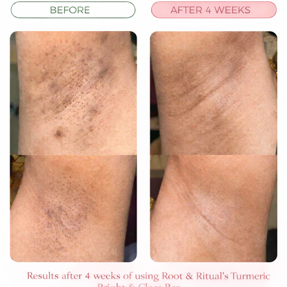 Turmeric Bright & Clear Bar