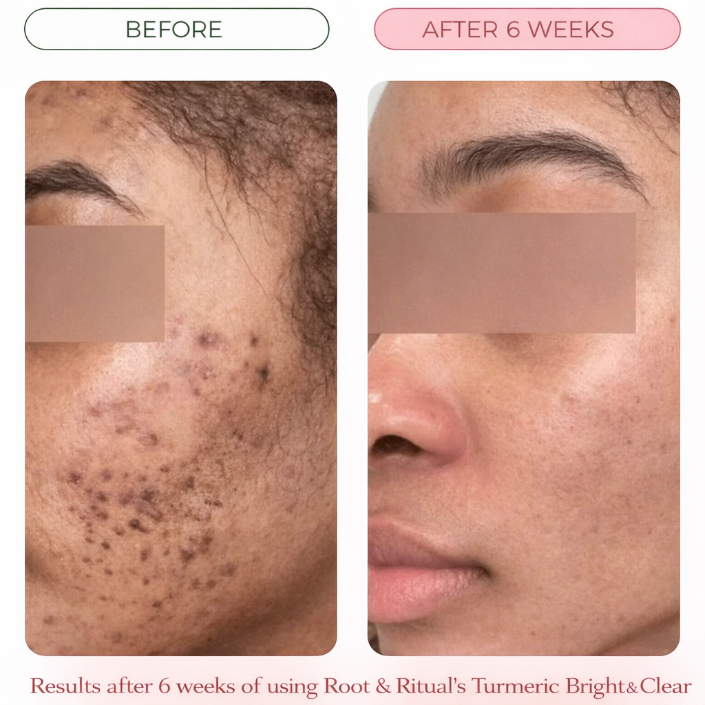 Turmeric Bright & Clear Bar