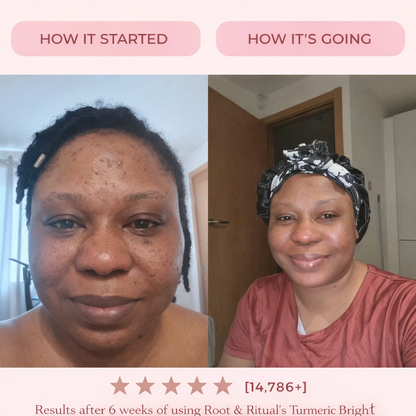 Turmeric Bright & Clear Bar